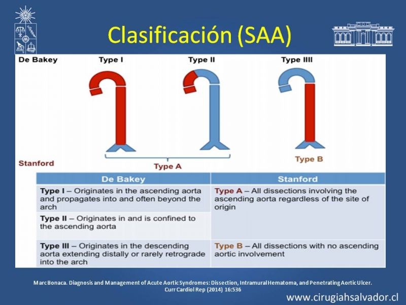 Diapositiva 8 de Sindrome Aórtico Agudo (SAA)
