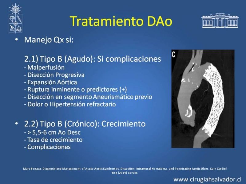 Diapositiva 33 de Sindrome Aórtico Agudo (SAA)