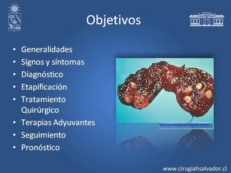 Diapositiva 1 de Cáncer Diferenciado de Tiroides