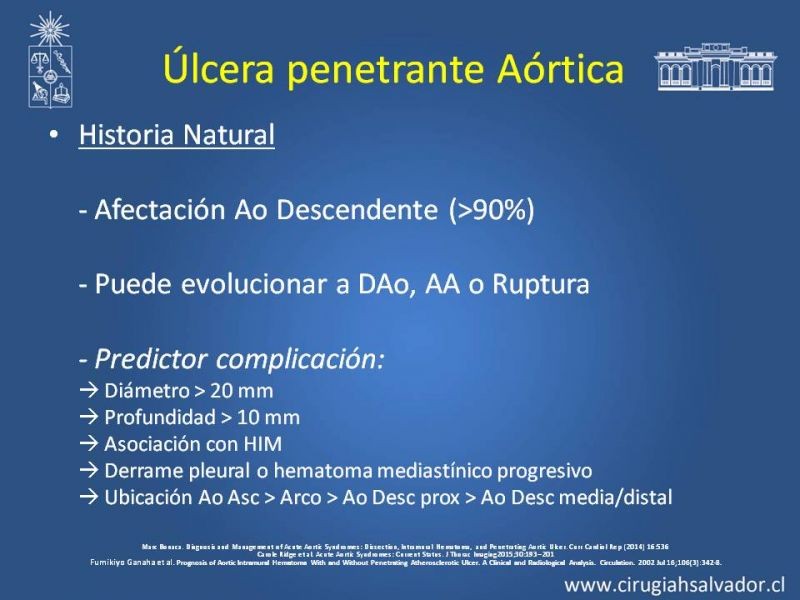 Diapositiva 29 de Sindrome Aórtico Agudo (SAA)