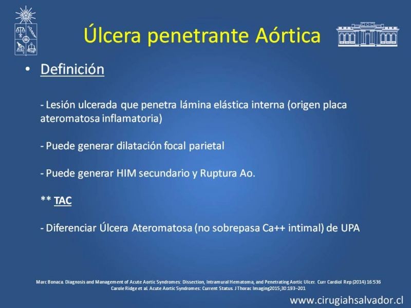 Diapositiva 25 de Sindrome Aórtico Agudo (SAA)