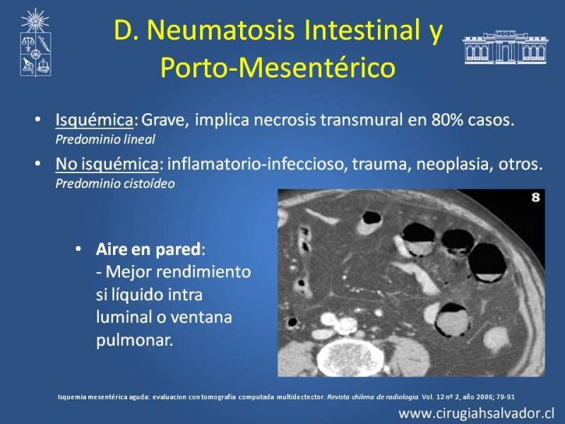 Diapositiva 20 de Isquemia Mesentérica