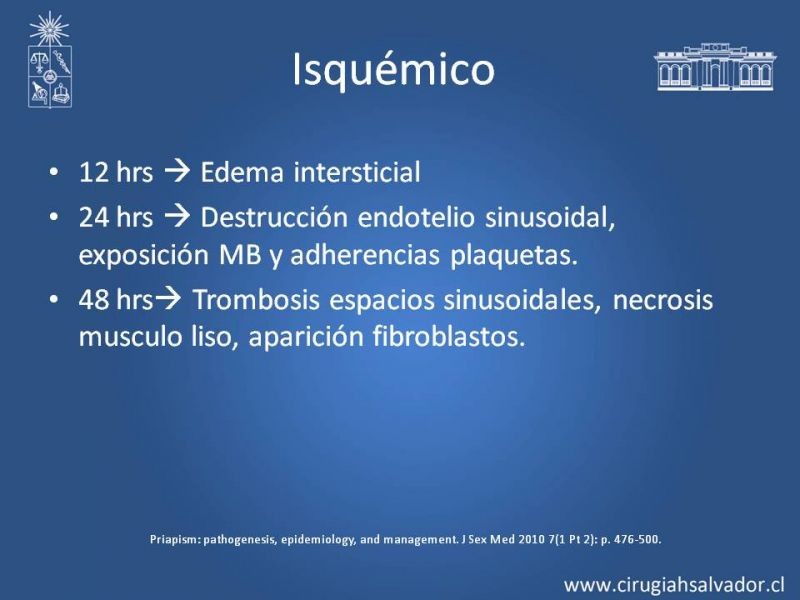 Diapositiva 7 de Priapismo