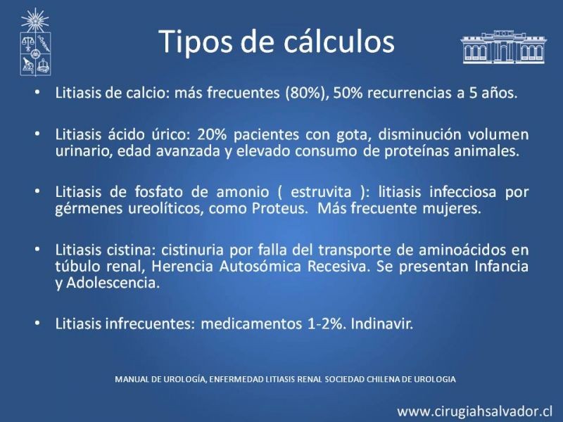 Diapositiva 4 de Manejo en Urgencia Urolitiasis 