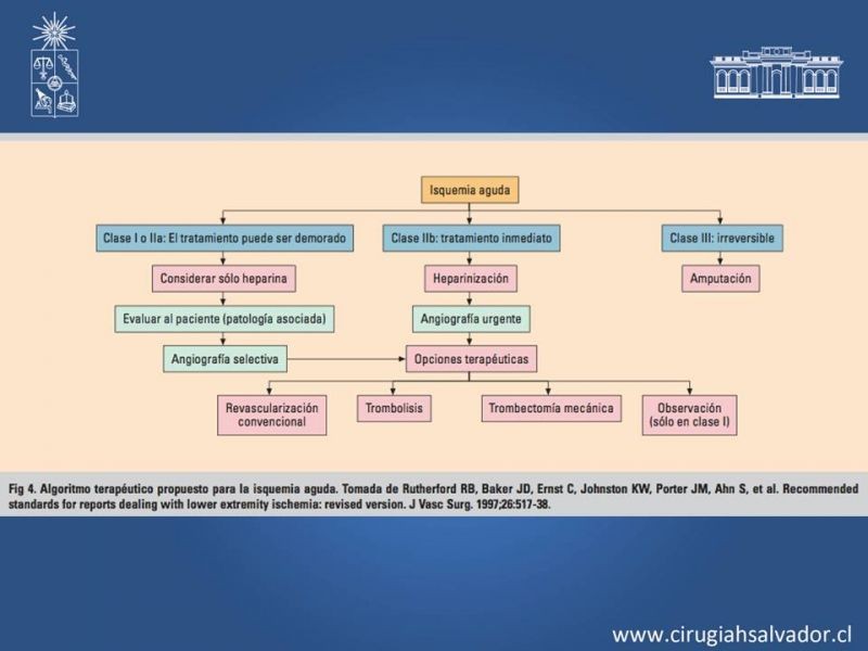 Diapositiva 17 de Isquemia aguda extremidades