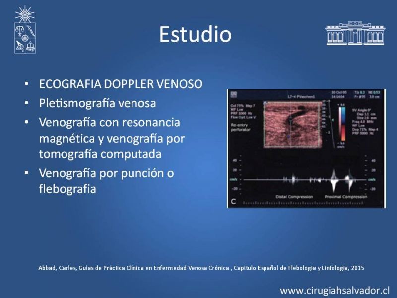 Diapositiva 12 de Insuficiencia venosa superficial