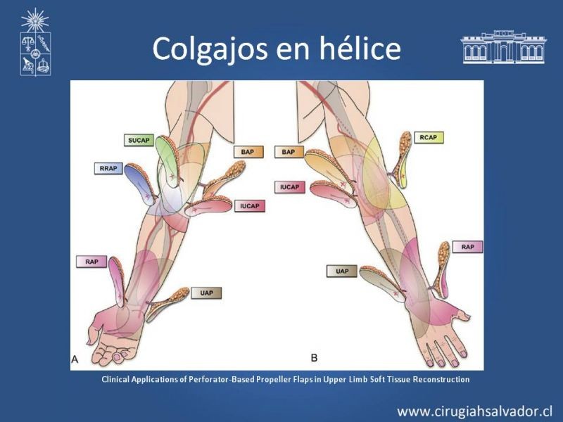 Diapositiva 23 de Usos de Colgajos Perforantes