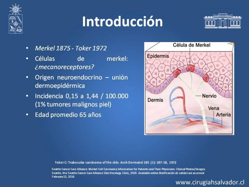 Diapositiva 1 de Tumores de células de Merkel