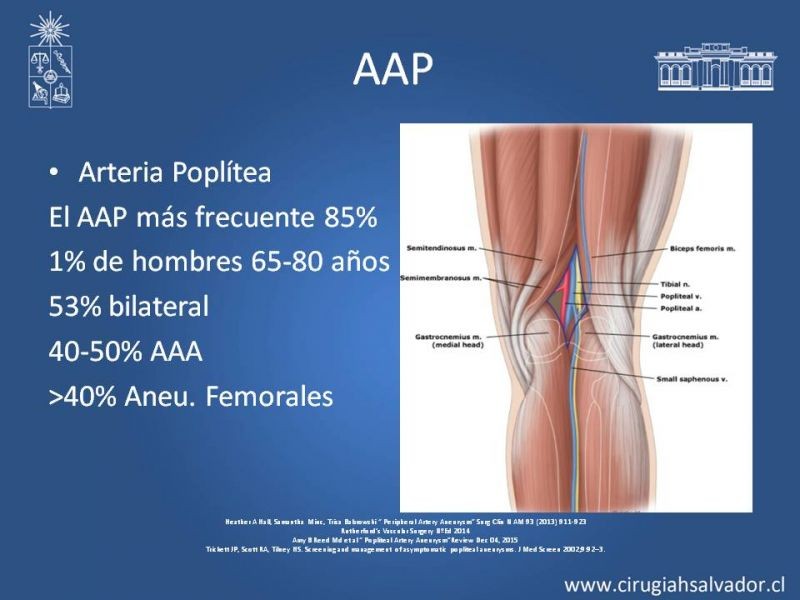 Diapositiva 10 de Aneurismas Perisféricos