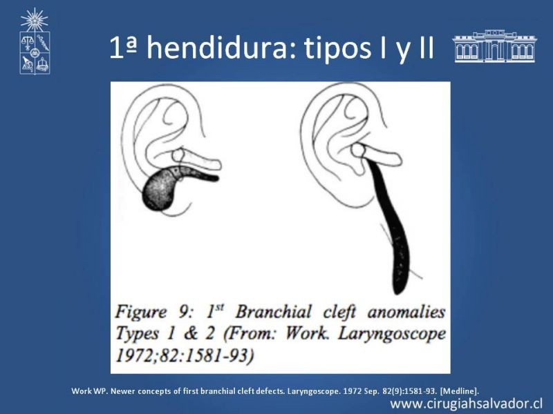 Diapositiva 8 de Quistes Branquiales