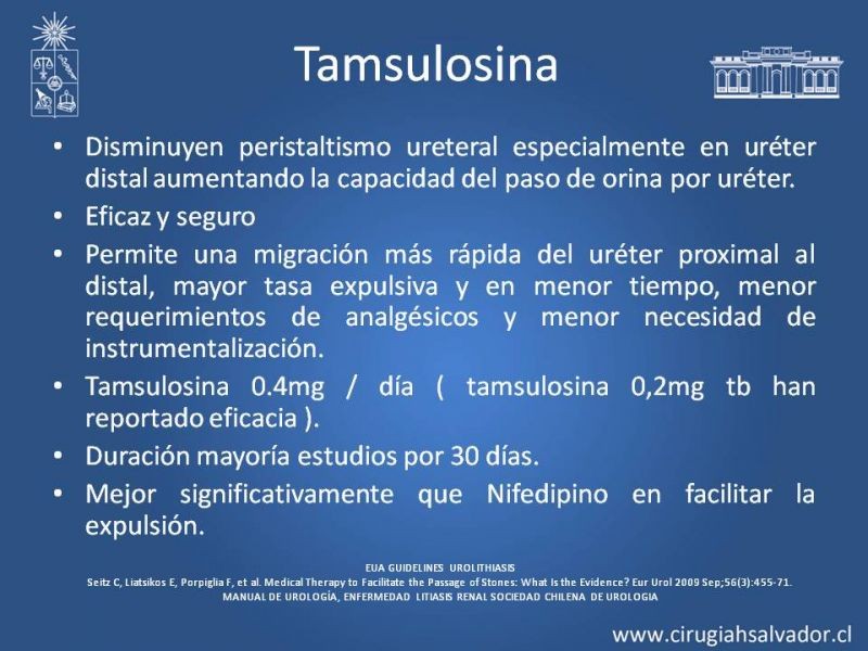 Diapositiva 18 de Manejo en Urgencia Urolitiasis 