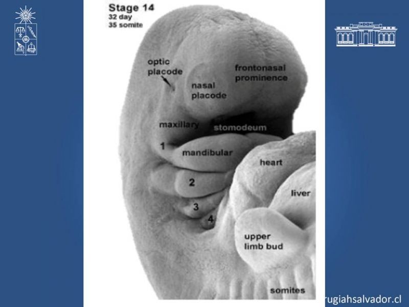 Diapositiva 3 de Quistes Branquiales