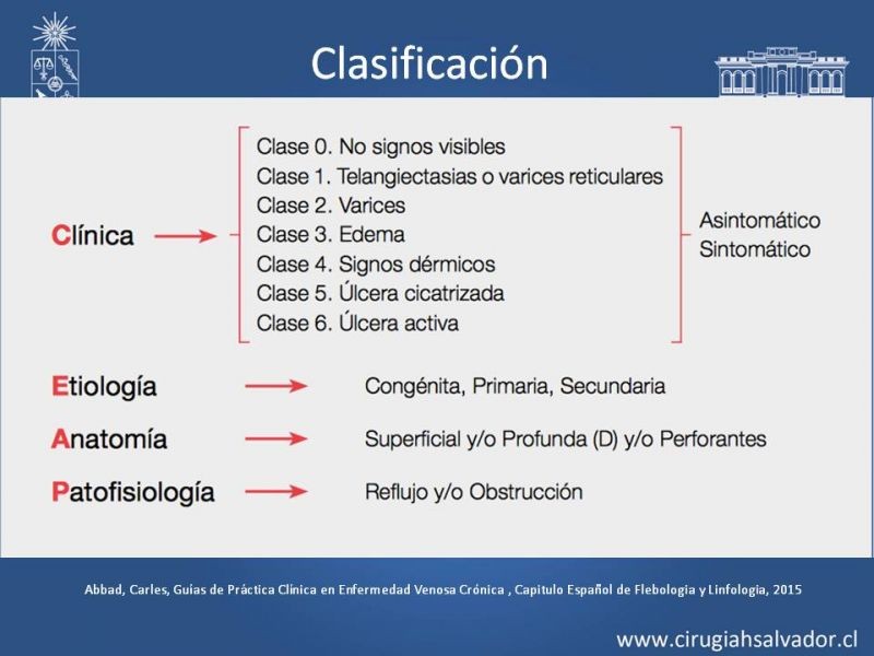 Diapositiva 8 de Insuficiencia venosa superficial