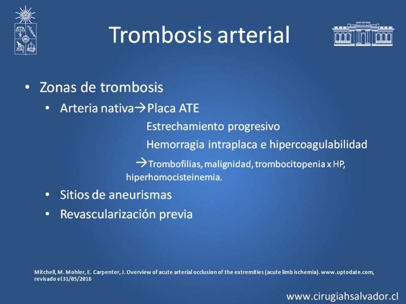 Diapositiva 5 de Isquemia aguda extremidades