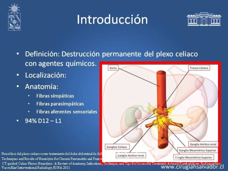 Diapositiva 4 de Alcoholización Plexo Solar