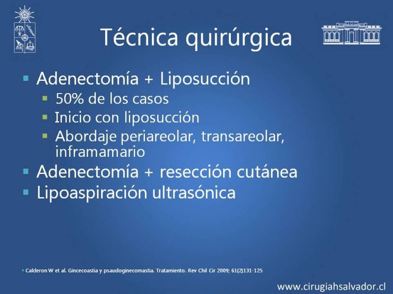 Diapositiva 11 de Ginecomastia