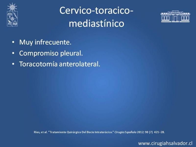 Diapositiva 21 de Bocio intratorácico