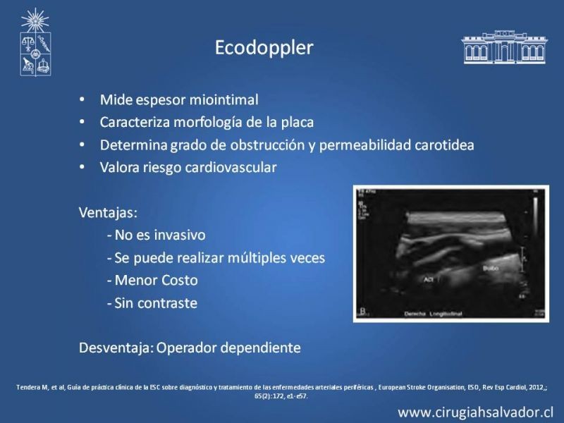 Diapositiva 12 de Estenosis Carotidea: Estudio y manejo quirúrgico