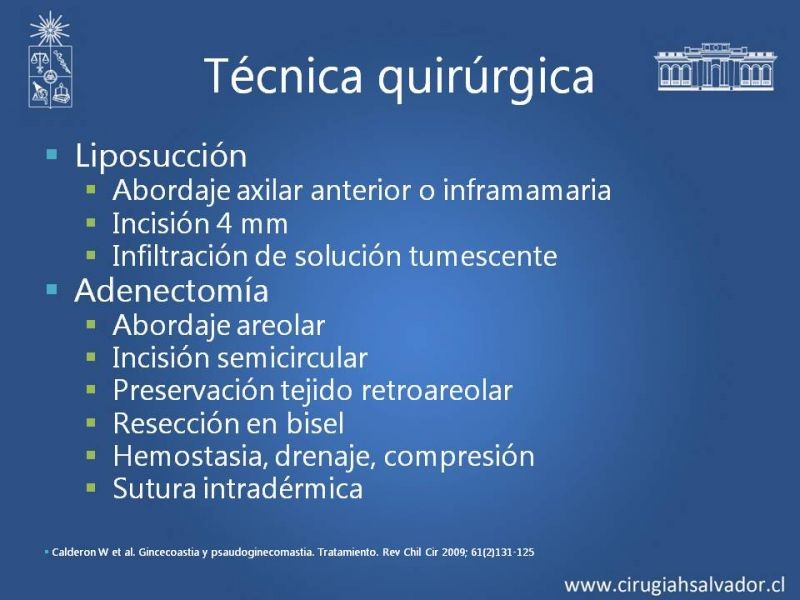 Diapositiva 10 de Ginecomastia