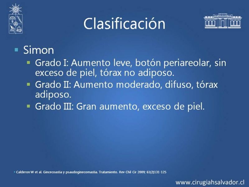 Diapositiva 7 de Ginecomastia