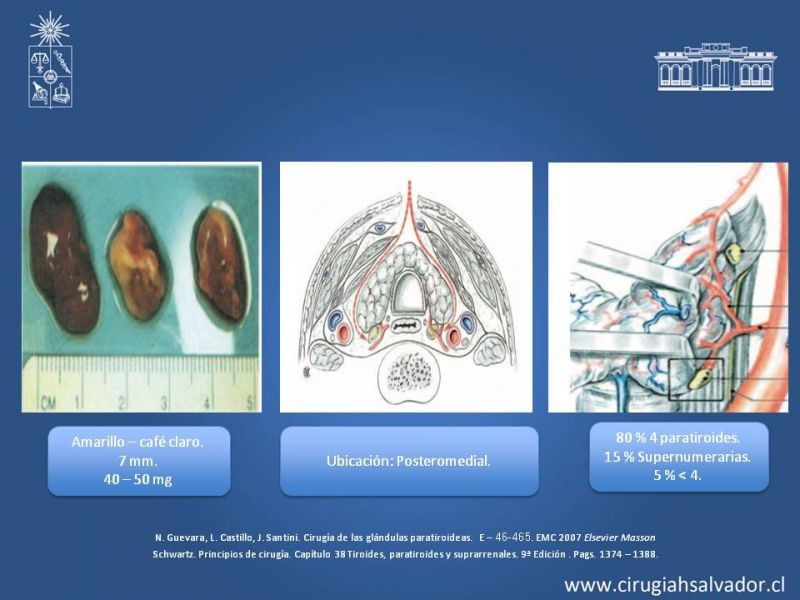 Diapositiva 2 de Hiperparatiroidismo 2º: Estudio, manejo e indicaciones quirúrgicas.