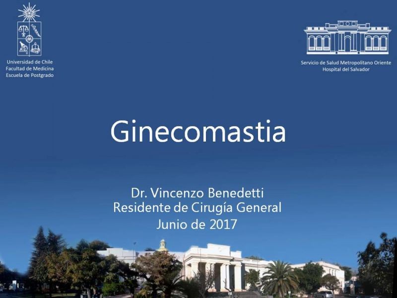 Diapositiva 21 de Ginecomastia