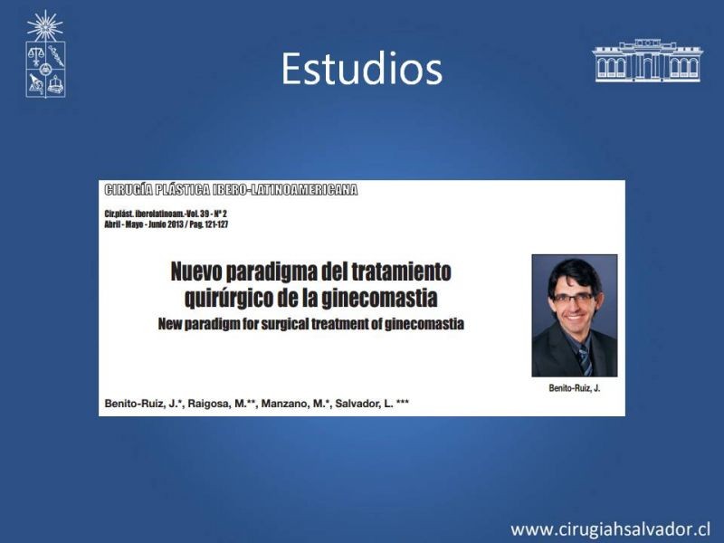 Diapositiva 18 de Ginecomastia
