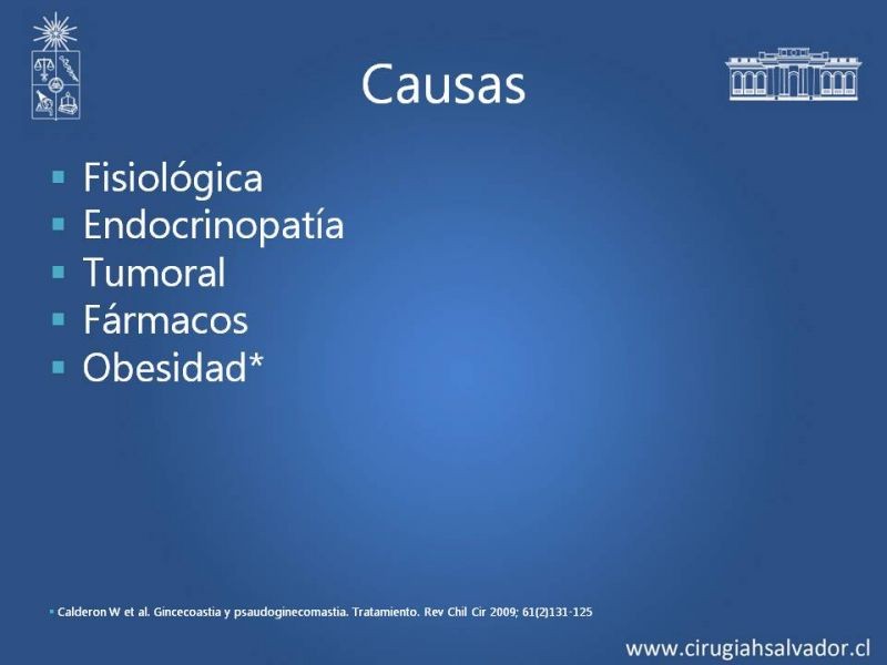 Diapositiva 4 de Ginecomastia