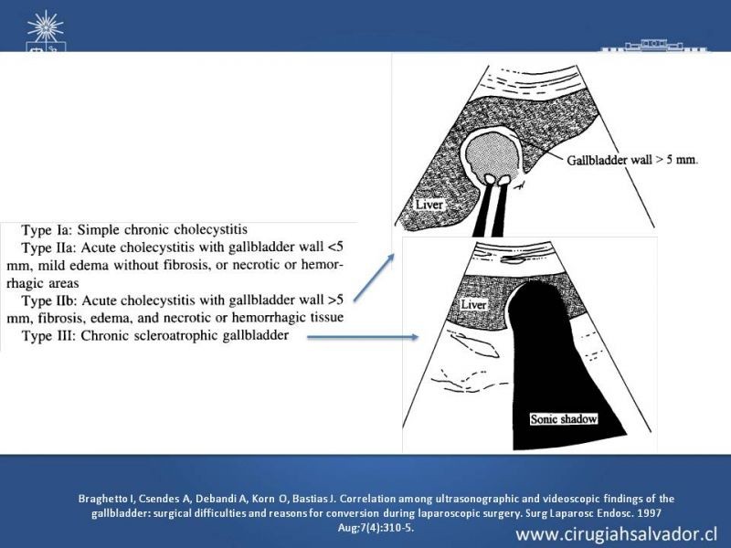 Diapositiva 38 de Vesícula Escleroatrófica