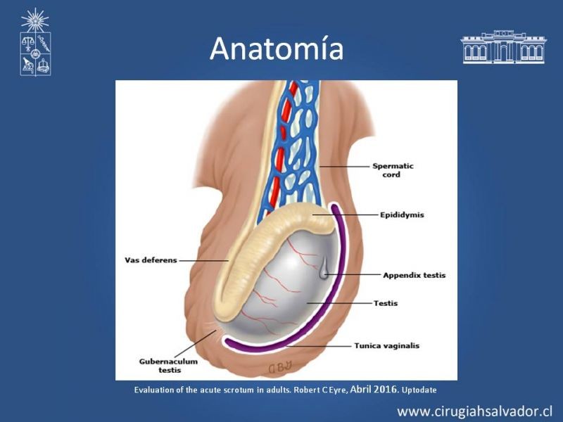 Diapositiva 4 de Manejo de Escroto Agudo