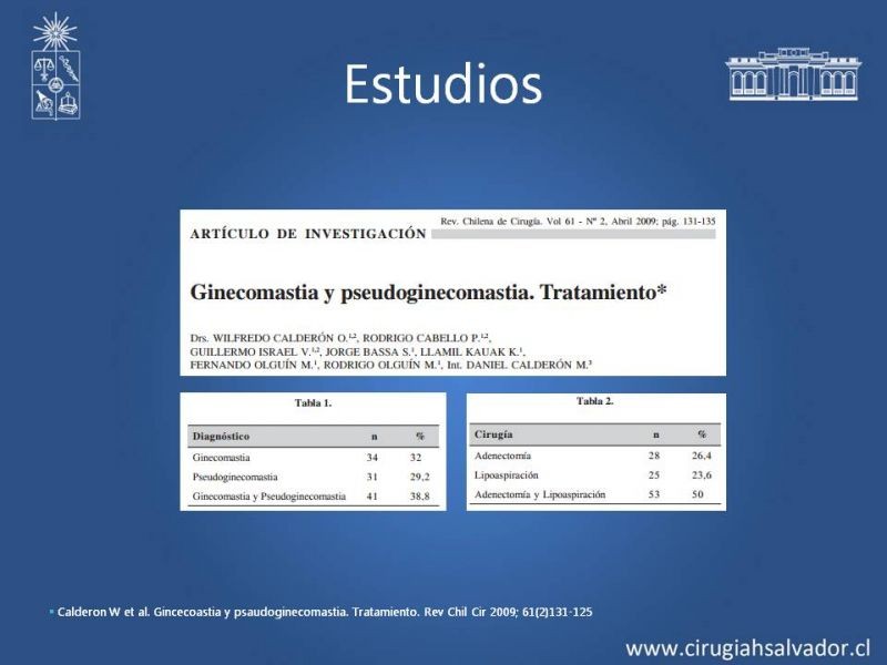 Diapositiva 14 de Ginecomastia