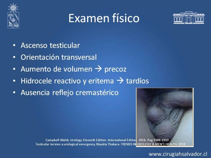 Diapositiva 9 de Manejo de Escroto Agudo