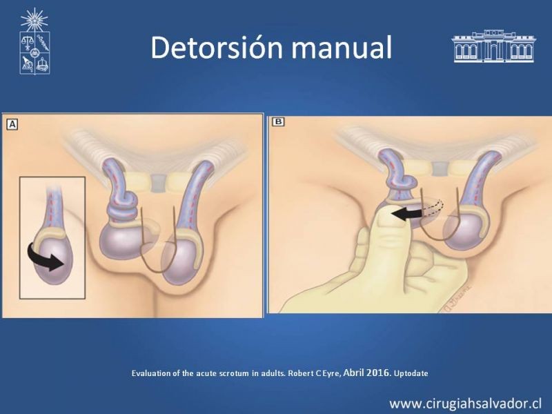 Diapositiva 12 de Manejo de Escroto Agudo