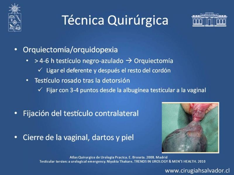 Diapositiva 16 de Manejo de Escroto Agudo