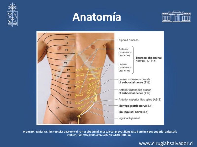 Diapositiva 6 de Lipectomía Abdominal