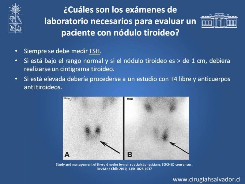 Diapositiva 12 de Nódulo Tiroideo