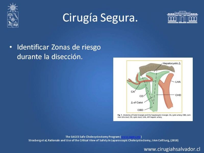 Diapositiva 21 de Colecsitectomía Segura