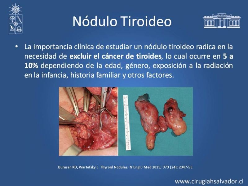 Diapositiva 5 de Nódulo Tiroideo