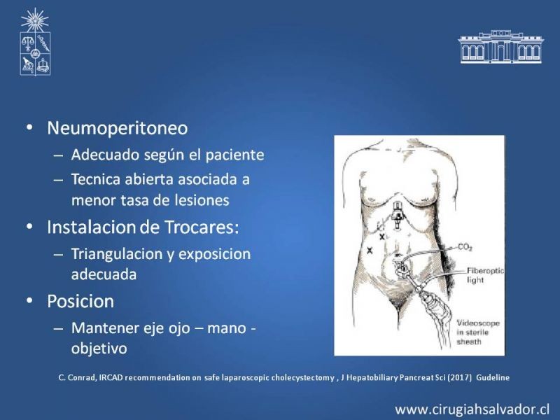 Diapositiva 7 de Colecsitectomía Segura