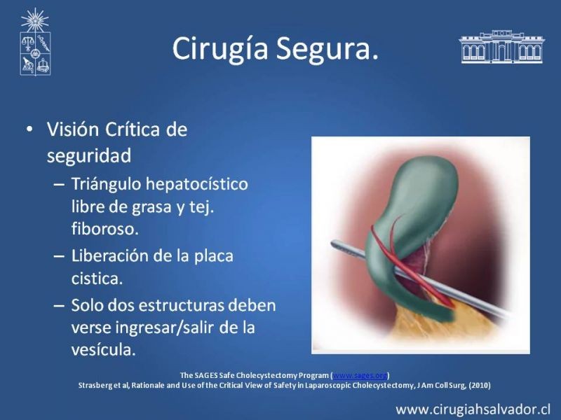 Diapositiva 11 de Colecsitectomía Segura