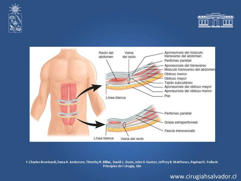 Diapositiva 4 de Lipectomía Abdominal