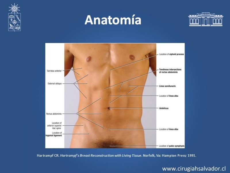 Diapositiva 3 de Lipectomía Abdominal