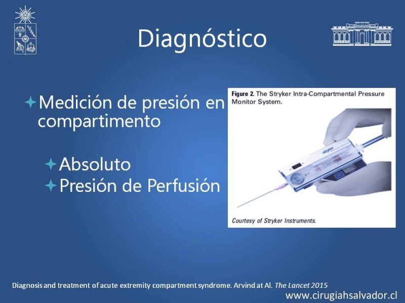 Diapositiva 12 de Síndrome Compartimental de Extremidades