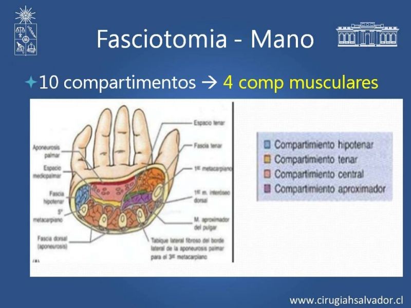 Diapositiva 31 de Síndrome Compartimental de Extremidades