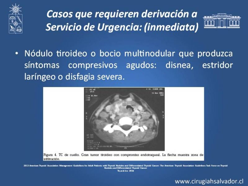Diapositiva 29 de Nódulo Tiroideo