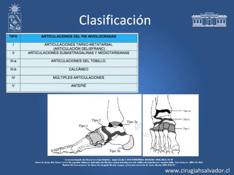 Diapositiva 8 de Artropatía de Charcot