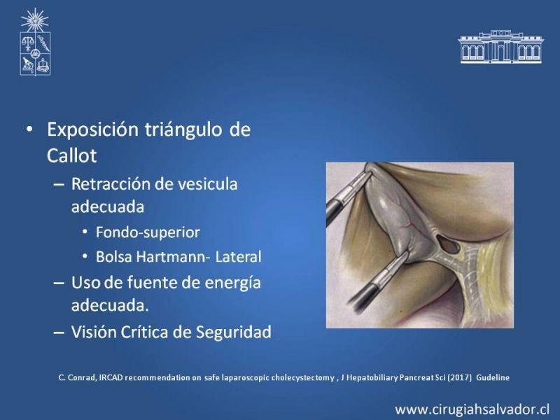 Diapositiva 8 de Colecsitectomía Segura