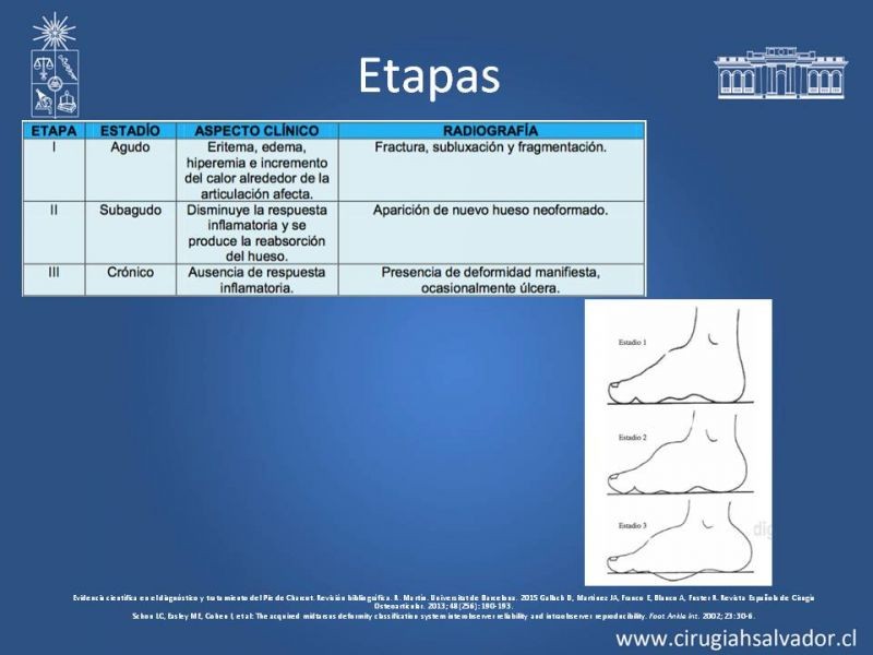 Diapositiva 6 de Artropatía de Charcot