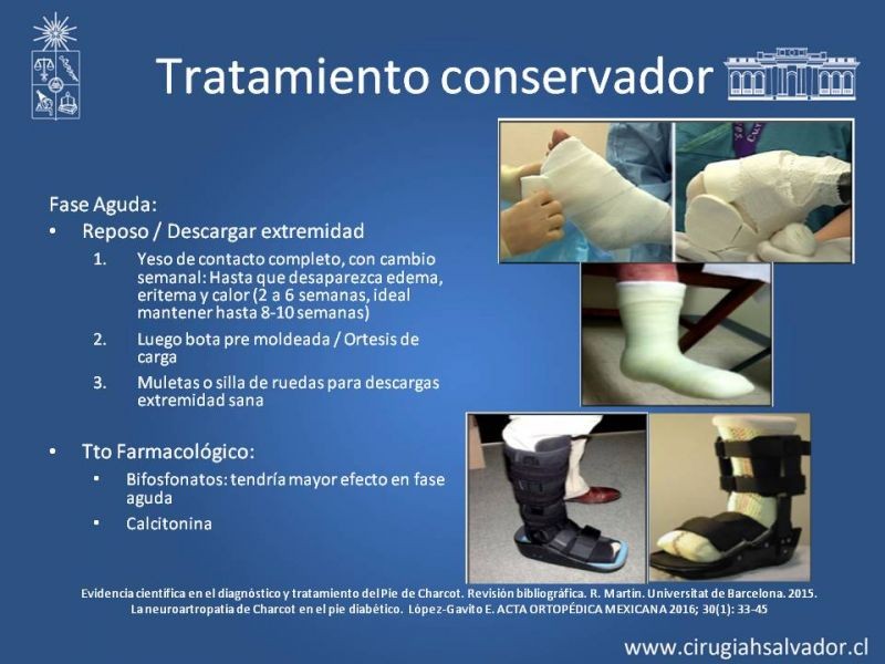 Diapositiva 18 de Artropatía de Charcot