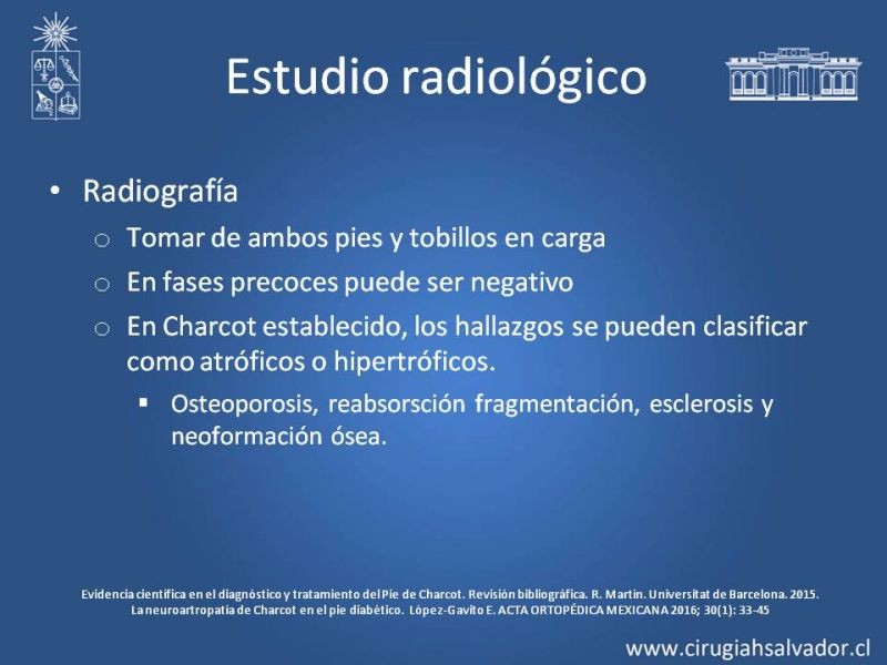 Diapositiva 12 de Artropatía de Charcot